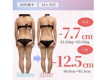 アフリオーラ はなみずき店(affriolant)/ビフォーアフター