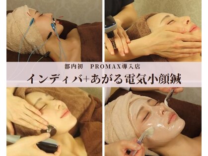 はにかむの写真
