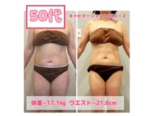 サロン ド フェイス モアナ(Salon de Faith Moana)の雰囲気（50代　キャビテーション24回コース体重マイナス17.1Kg！!）