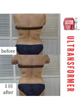 アップルミント/＜痩身＞before・after