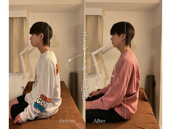 ロアー 赤坂店(RAWR)/骨格矯正でストレートネック改善