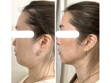 ポモナ 横浜馬車道店(Pomona)/当店オーナーレモンボトル６回！