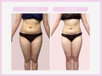 アコガレコガオ 秋田店/