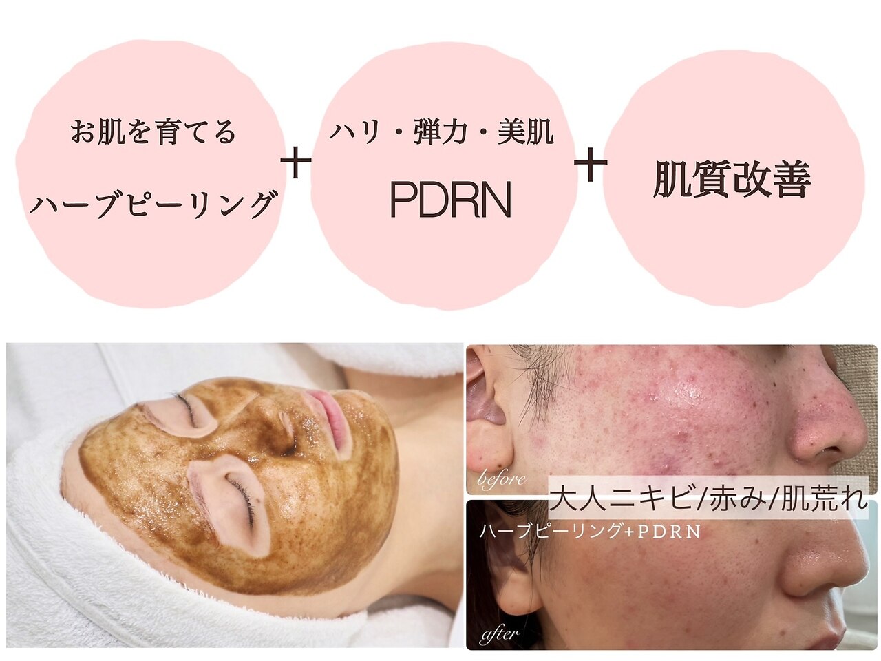 ネージュ(Neige)｜ホットペッパービューティー