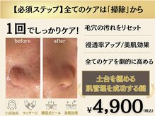 イーラボ 池袋店(e-LABO)の雰囲気（毛穴洗浄◎毛穴の角質、黒ずみ汚れにはこれ一択！定期的に掃除♪）