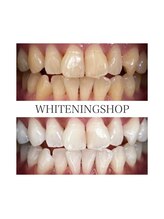 ホワイトニングショップ 徳島店/Before&After美白ホワイトニング