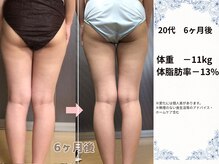 ヨサパーク ブリス(YOSA PARK blis)/20代　6ヶ月