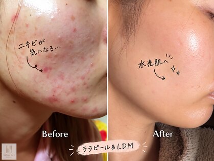 サロン ド エス アオヤマ(SALON DE S AOYAMA)の写真