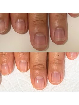 ウェルズユキ(well's yuki)/自爪育成 自爪ケア