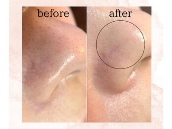 シェリール(cherir)/