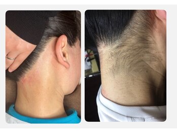 トータル ビューティ フィット/