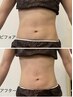 【痩身】【レディース＆メンズ】お腹集中痩身！徹底脂肪燃焼　