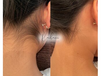 カイラニ サロン(Kai lanl salon)/女性　うなじ