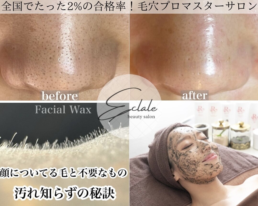 エクラーレ(Eclale)｜ホットペッパービューティー