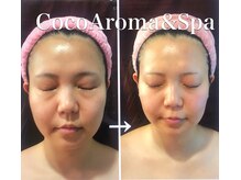 姫路で本格的な韓国美容はココアロマ