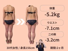 エステティックトレーニングサロン ボディネイト(Body Nate)/Before/After