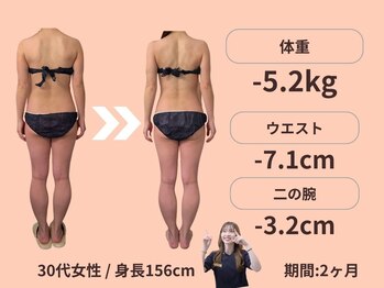 エステティックトレーニングサロン ボディネイト(Body Nate)/Before/After