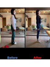 セカンドシーズンエス(2nd.season.S)/猫背の改善には骨盤矯正が必須♪