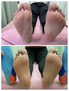 ナカザワ(NAKAZAWA)/軸が真っすぐスッキリした足に♪