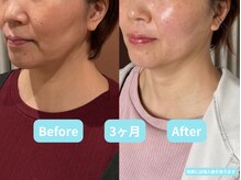 ホープ鍼灸整骨院の雰囲気(通うたびにに鏡を見るのが楽しくなる!とお言葉をいただきました)