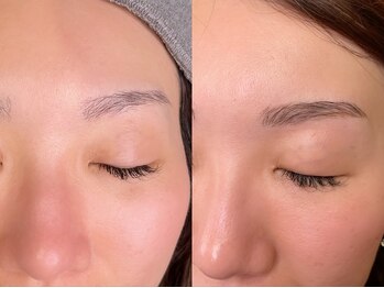 マミー(mammy)/ハリウッドブロウリフト