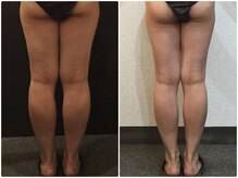 美容整体ウェリナ 名駅院/小顔矯正/骨盤矯正/美脚サロン