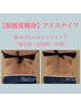 new☆痩身☆アイスナイフ脂肪分解！冷たい×温かいで脂肪撃退＆引締め
