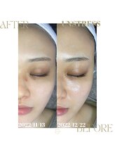 ネス 沖縄店(Nes.)/UNSTRESS/アンスレス