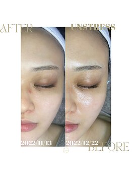 ネス 沖縄店(Nes.)/UNSTRESS/アンスレス