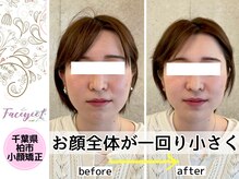 フェイシー(faceyee)/