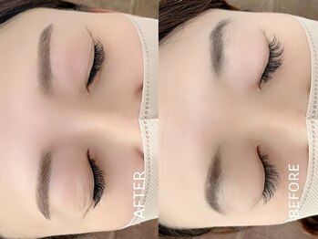 リュクス/ストレートアーチ