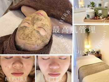 ハーブピーリング 恵比寿