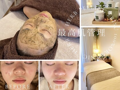 ハーブピーリング 恵比寿の写真