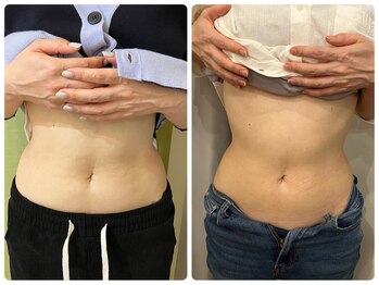 ポモナ 横浜馬車道店(Pomona)/レモンボトル5回の変化!