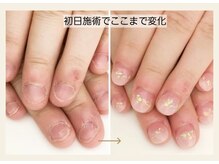 キュアネイル(Qa Nail)