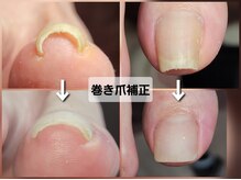 エーケーネイル(AKnail)の雰囲気(巻き爪補正)