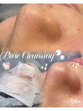 ラティーナ(Lattina)/角栓/毛穴　毛穴洗浄