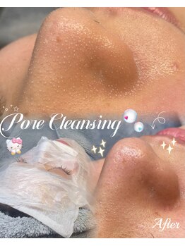 ラティーナ(Lattina)/角栓/毛穴　毛穴洗浄