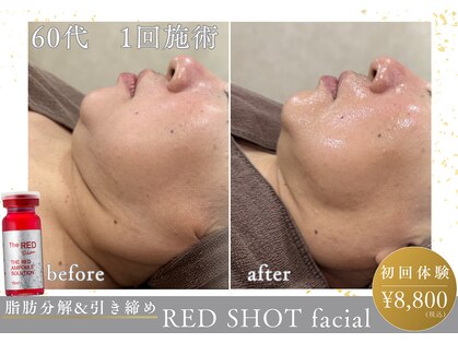 ナチュールファースト(naturel first)の写真