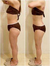 モカ(MOKA)/痩身マシン&発汗温活デトックス