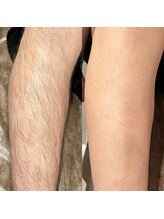 ハリウッドブロウリフト ワクシー 蒲田店(HOLLYWOOD BROW LIFT WAXYYY.)/W脱毛！