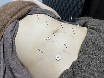 オレンジフラワープラス(orangeflower+)/強いストレスにはお腹の鍼灸施術