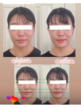 ブリリアント 西宮(Brilliant)/小顔に見えます