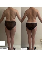 フェミニー(Feminy)/全身痩せ