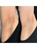 ローマピンク☆【脇】モニター限定40%OFF！アフタークリーム3本付き◎
