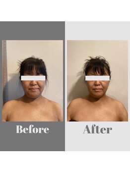 美バディ(美buddy)/フェイスラインもスッキリ