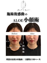 アロエ鍼灸整体院/Before-After