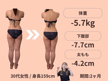 エステティックトレーニングサロン ボディネイト(Body Nate)/Before/After