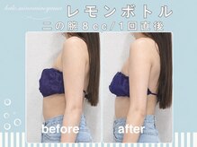 ハロ 南青山(HALO)の雰囲気（痛みが少なく効果のある機器のみを厳選☆1回目から確実に変化）