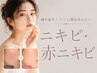【根本ニキビケア】剥離なしハーブピーリング＋プラズマシャワー＋毛穴パック